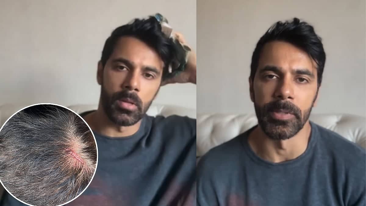 Anuj Sachdeva's Assault: Mumbai Police, What Are You Doing?