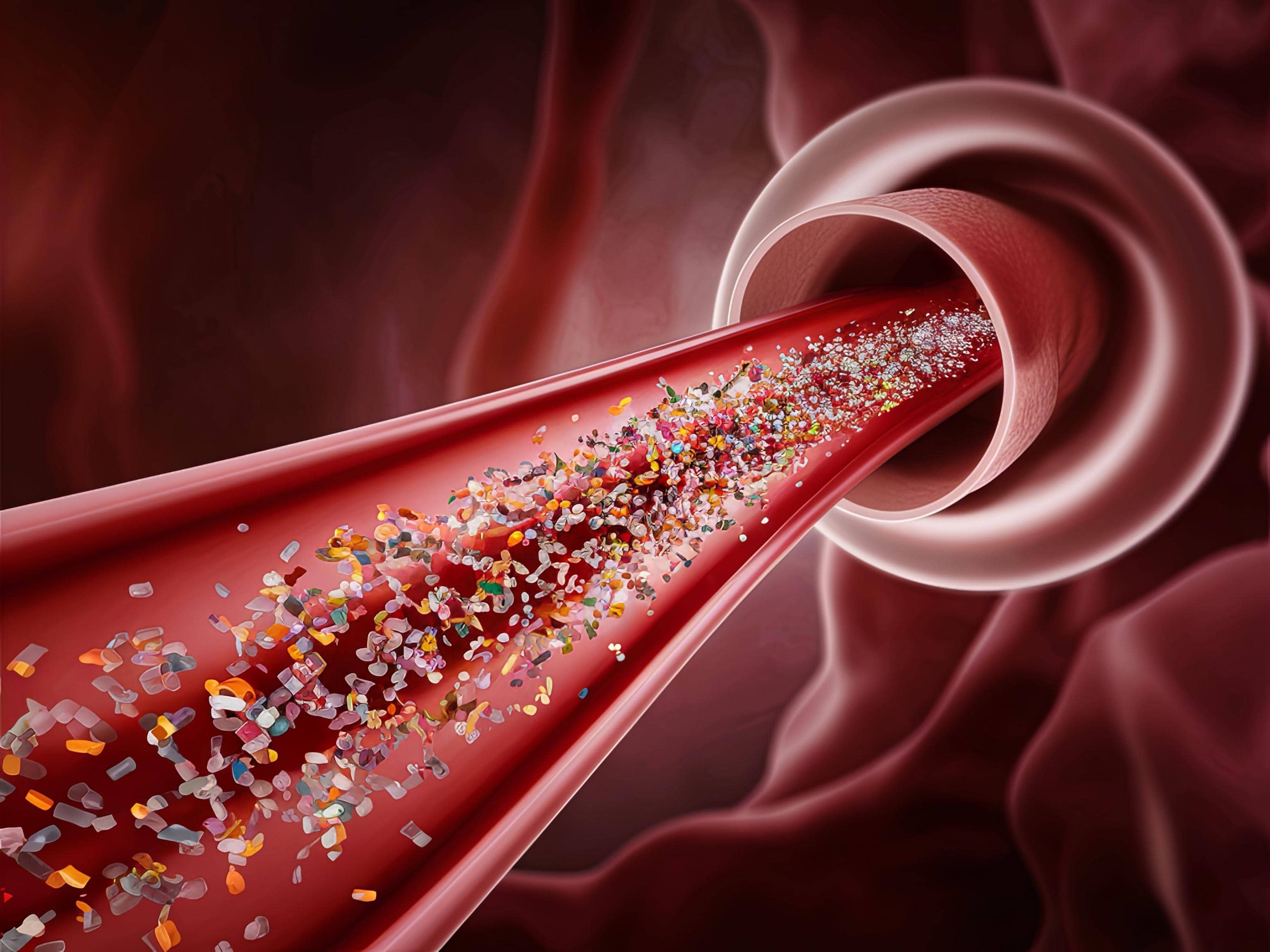 Microplastics: The Shocking Truth About Your Arteries, Folks