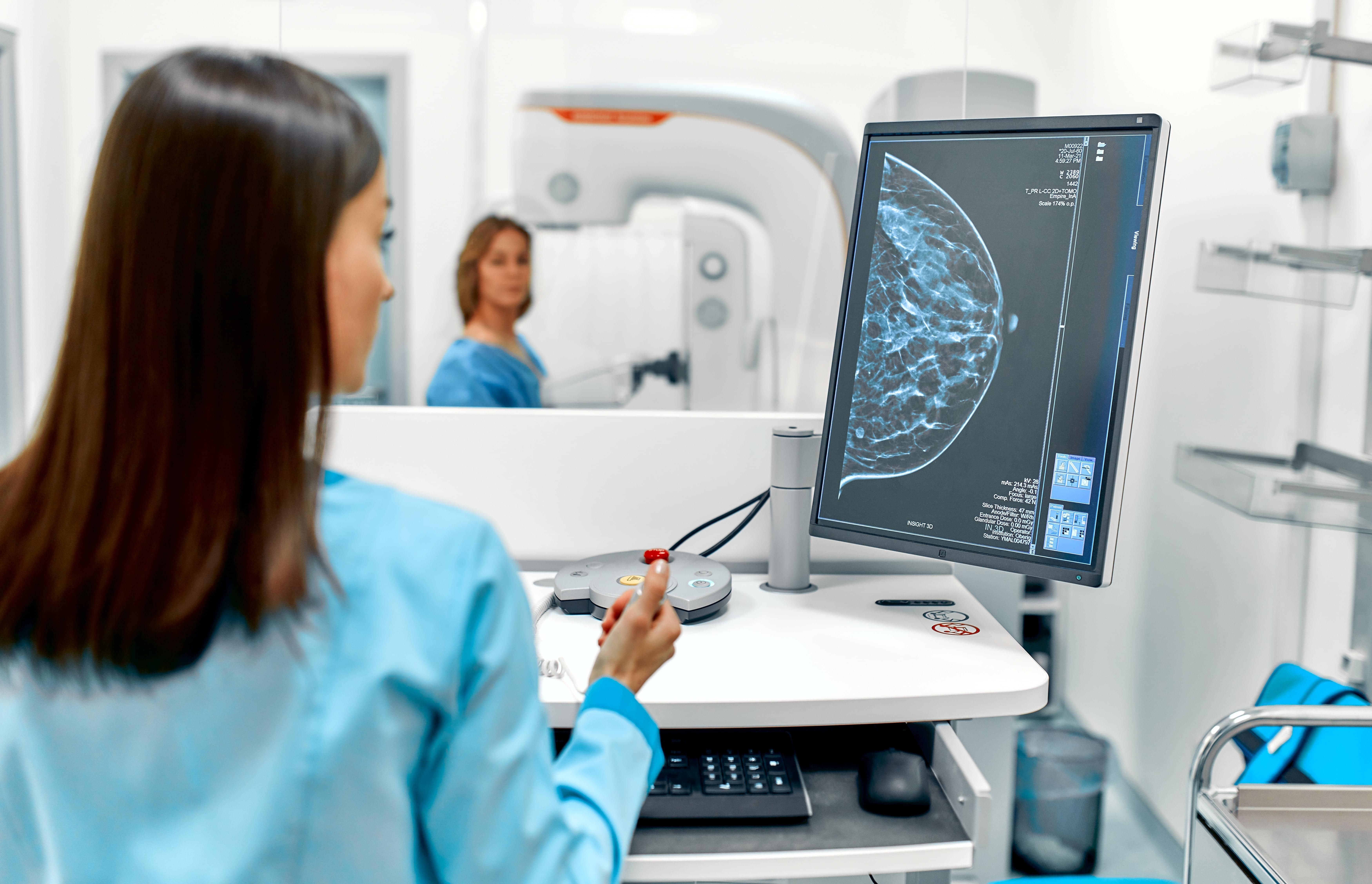 AI Takes on Breast Cancer: The Study That Packs a Punch!