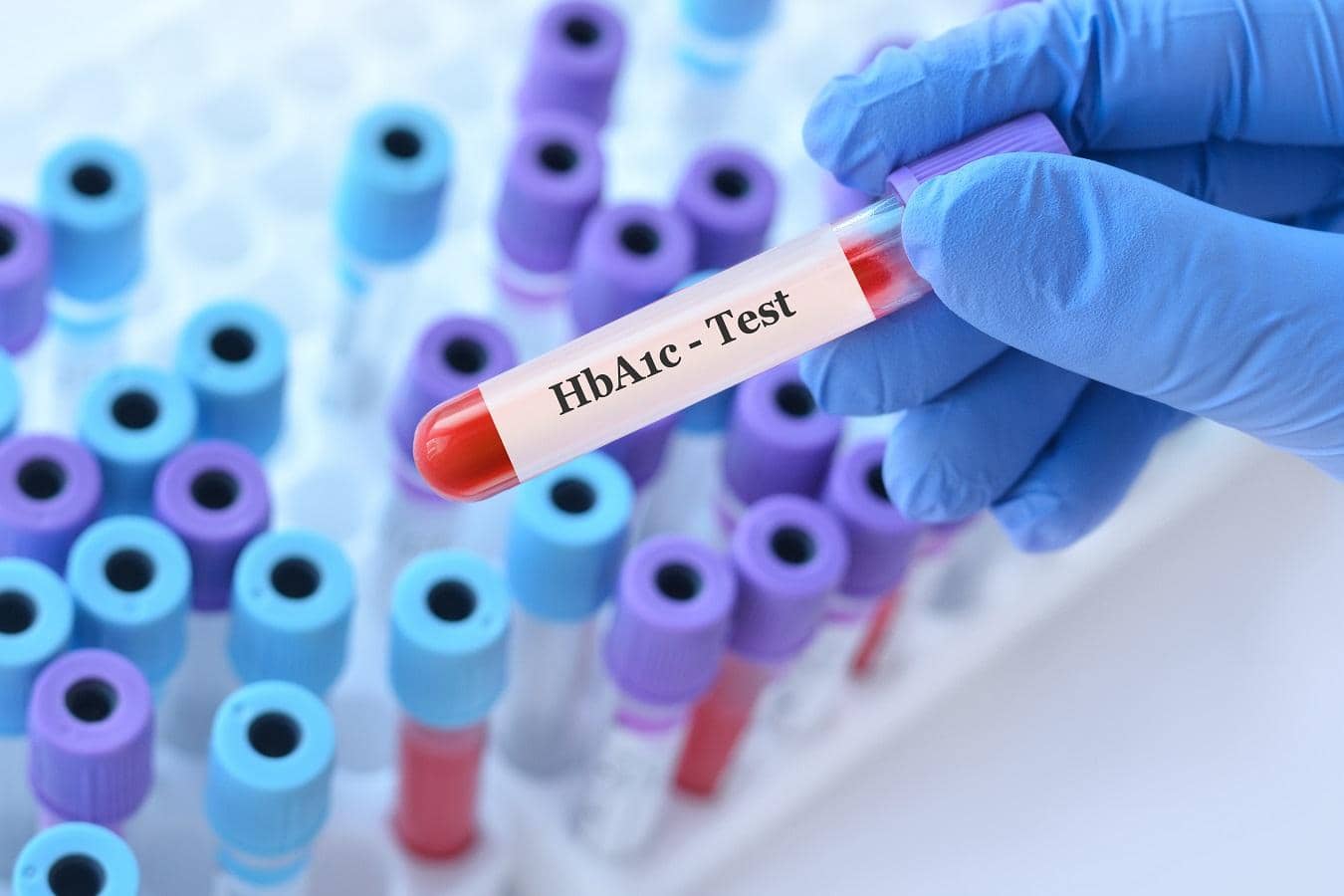 HbA1c Test Failing India: Time for a Major Shake-Up!