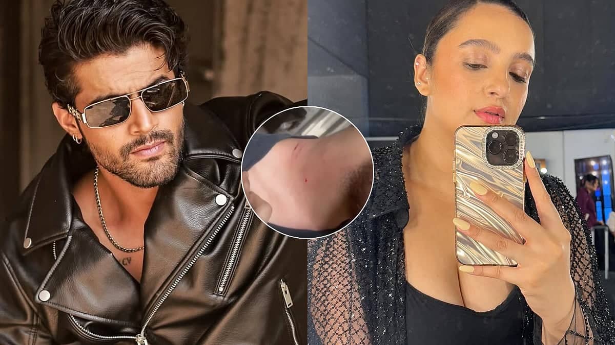 Splitsvilla 16's Sorab Bedi Attacked By His Ex-Girlfriend? VIDEO Shows Bleeding Scratch Marks On His Neck Amid Cheating Claims