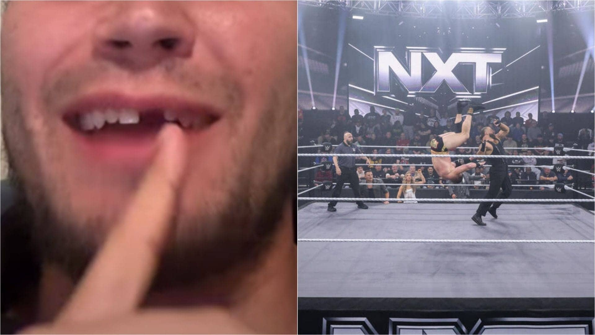 Shiloh Hill Loses Tooth Again in Epic WWE NXT Showdown