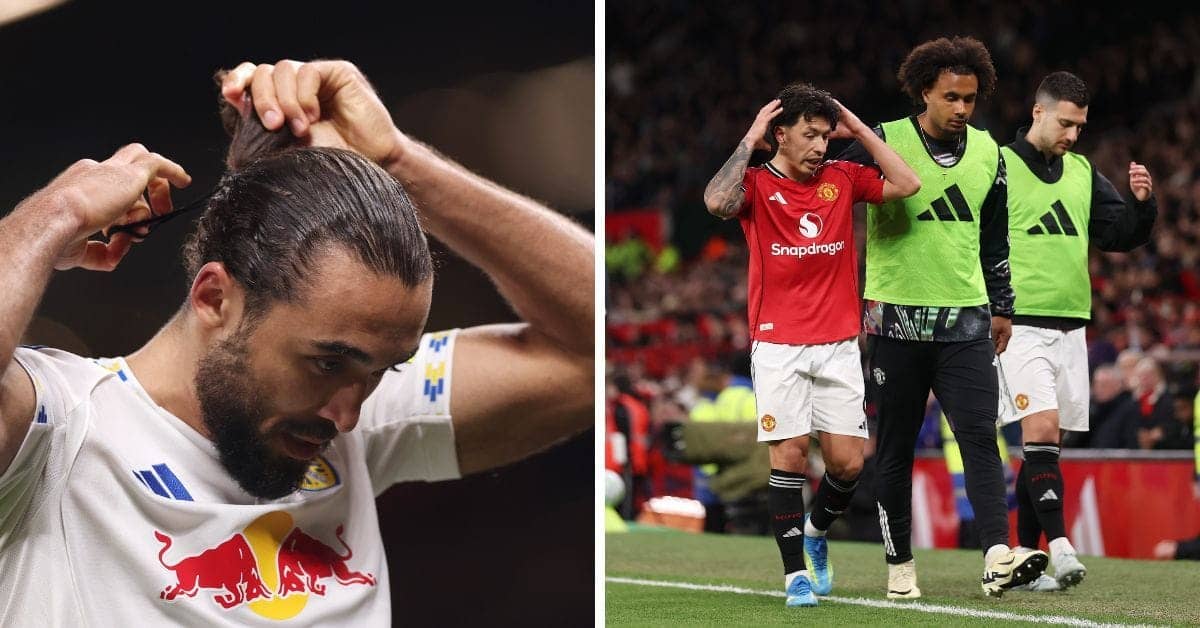 Calvert-Lewin Exposes Hair-Pulling Drama, What a Show!