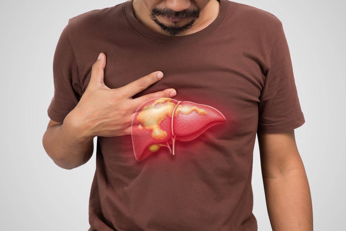 1.3 Billion People Battling Liver Issues in 2023: Uh-oh!