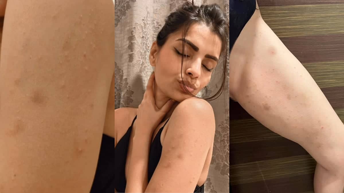 Sonali Raut Unveils Bigg Boss Marathi 6 Hygiene Nightmare