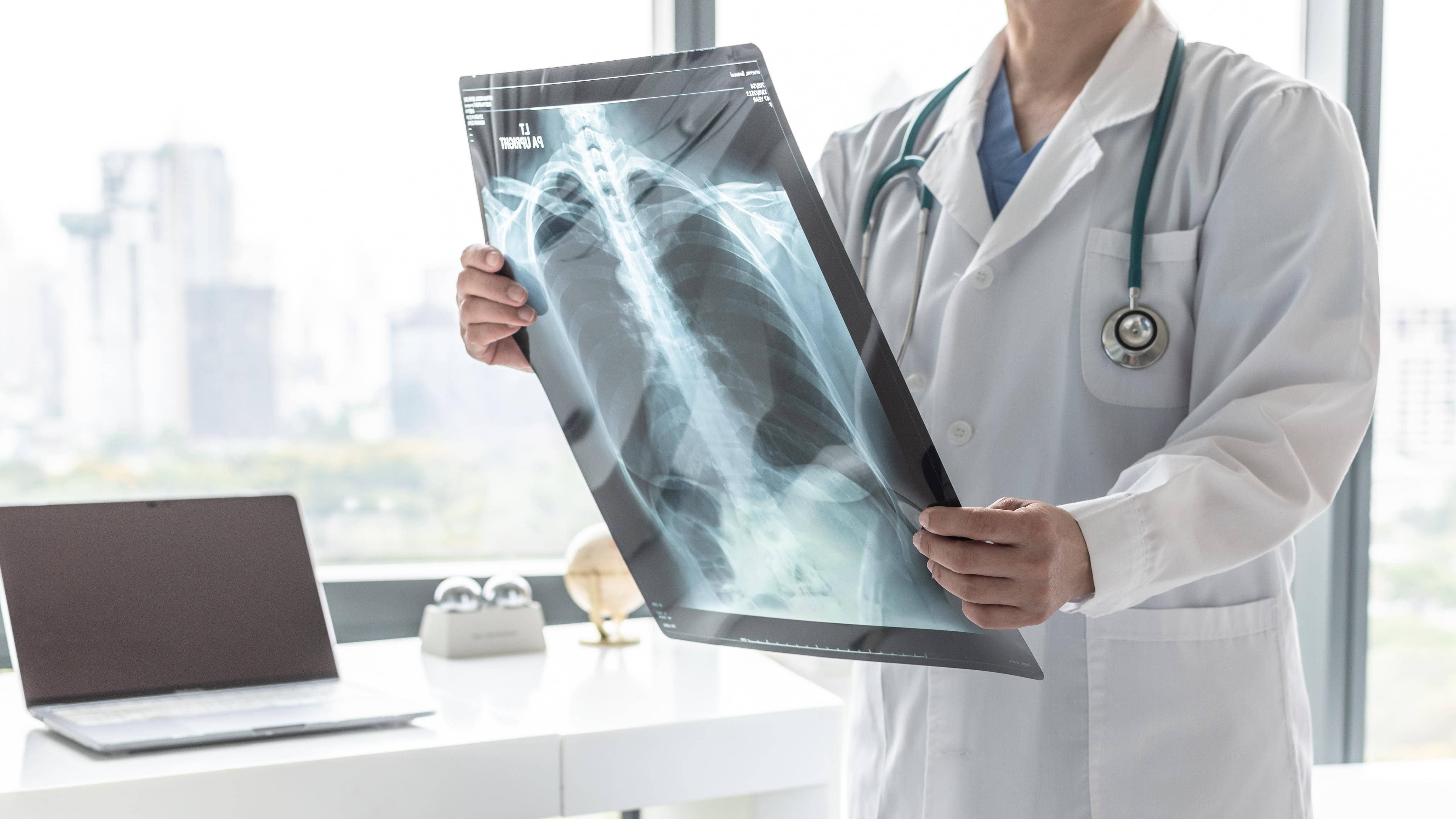 Tackle Undernutrition to Slash TB Cases by 2.3 Million