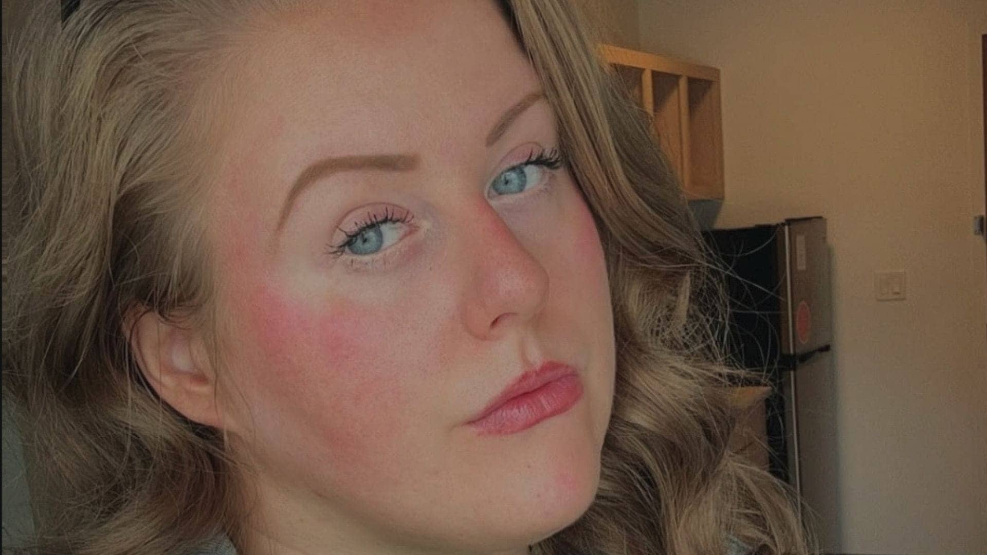 Piper Niven's Surgery Journey: A Strong Comeback Ahead
