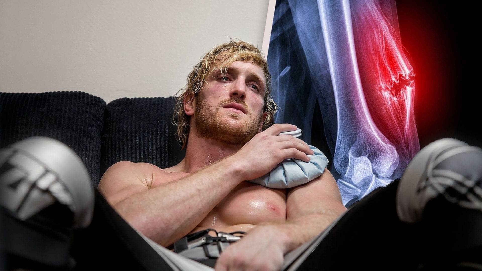 Logan Paul's Tricep Tumble: Recovery Adventures Unfold