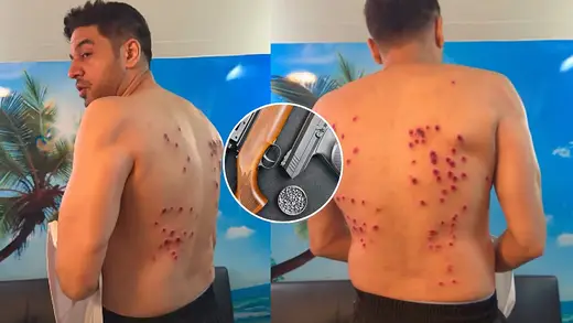 Gaurav Khanna's Wild Ride with Rubber Bullets on Khatron Ke Khiladi