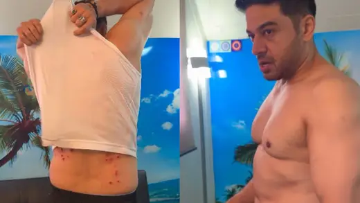 Gaurav's Battle Scars Ignite a Social Media Frenzy!